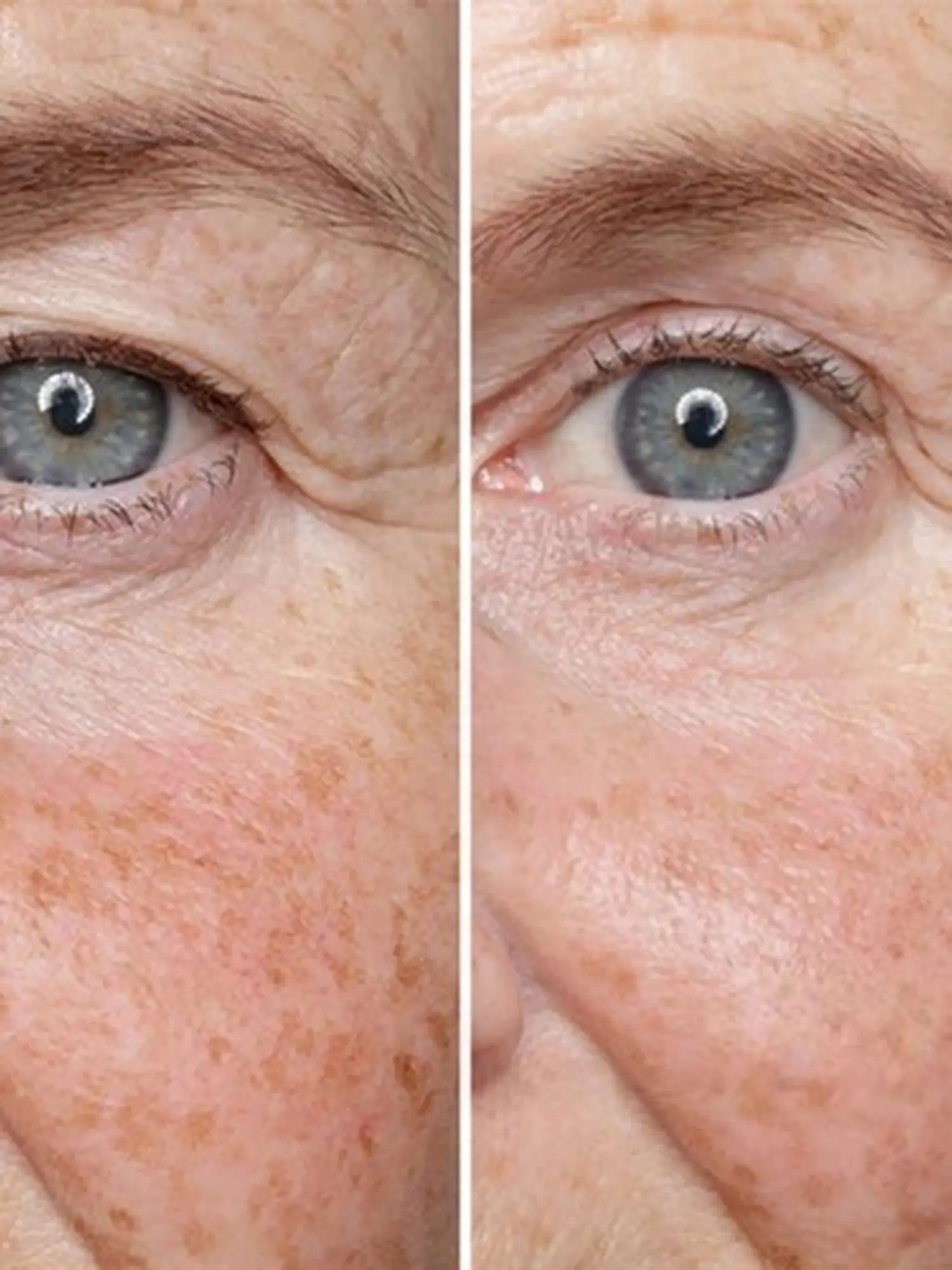 Крем для век против морщин HSR Lifting Eye Cream - изображение 5